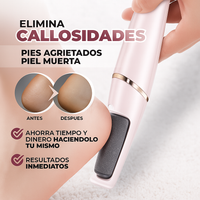 Removedor de callos