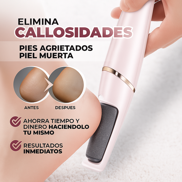 Removedor de callos