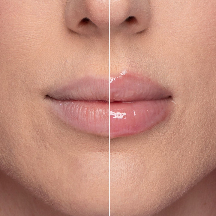 LipGloss Maximizer